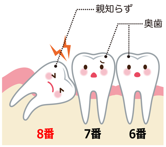 親知らずの治療 本八幡駅徒歩約2分のささがわ歯科クリニック
